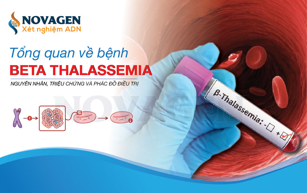 Tổng Quan Bệnh Beta Thalassemia: Nguyên Nhân, Triệu Chứng Và Phác Đồ Điều Trị