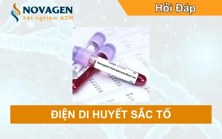 Xét nghiệm điện di huyết sắc tố: Chìa khóa tầm soát Thalassemia hiệu quả