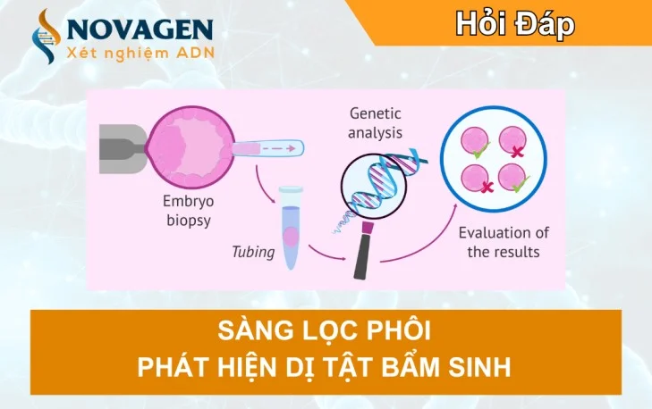 Sàng Lọc Phôi Phát Hiện Dị Tật Bẩm Sinh – Mẹ Bầu Cần Biết