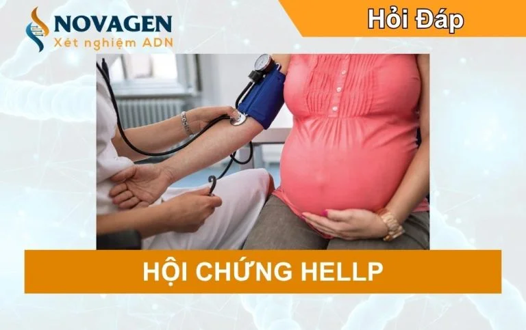 Hội chứng HELLP – Hướng dẫn đầy đủ dành cho Mẹ bầu