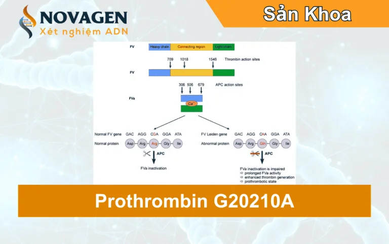 Prothrombin G20210A là gì? Có gây sảy thai không?