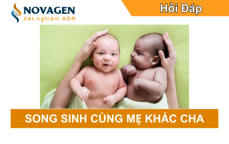 Song sinh cùng mẹ khác cha là gì, cơ chế khoa học và vai trò xét nghiệm ADN