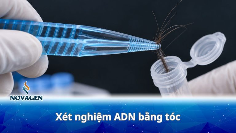 Xét nghiệm ADN bằng tóc: Cần tóc có chân không, độ chính xác ra sao?