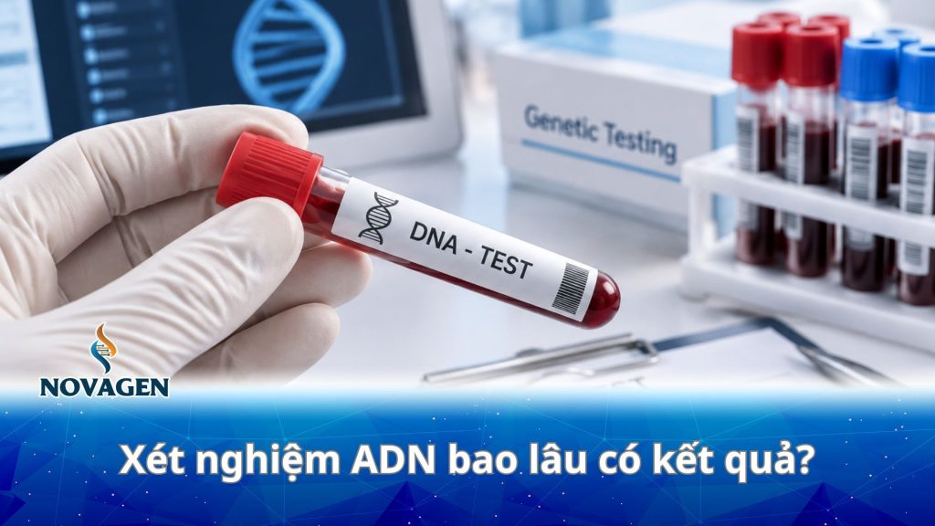 Xét nghiệm ADN bao lâu có kết quả? Bảng giá nhận kết quả nhanh [Mới nhất]