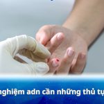 Xét nghiệm adn cần những thủ tục gì và 5+ lưu ý quan trọng
