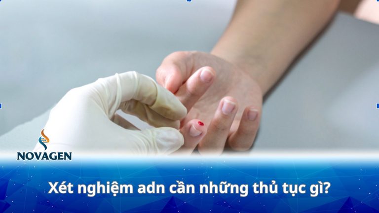 Xét nghiệm adn cần những thủ tục gì và 5+ lưu ý quan trọng
